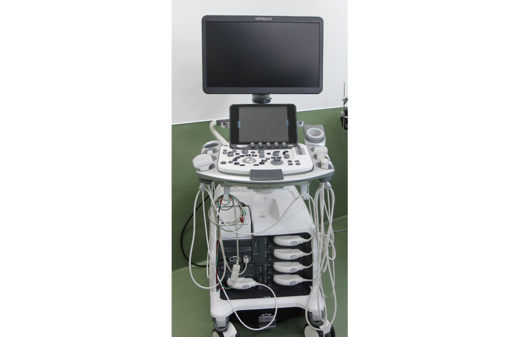 超音波診断装置（ARIETTA850SE）